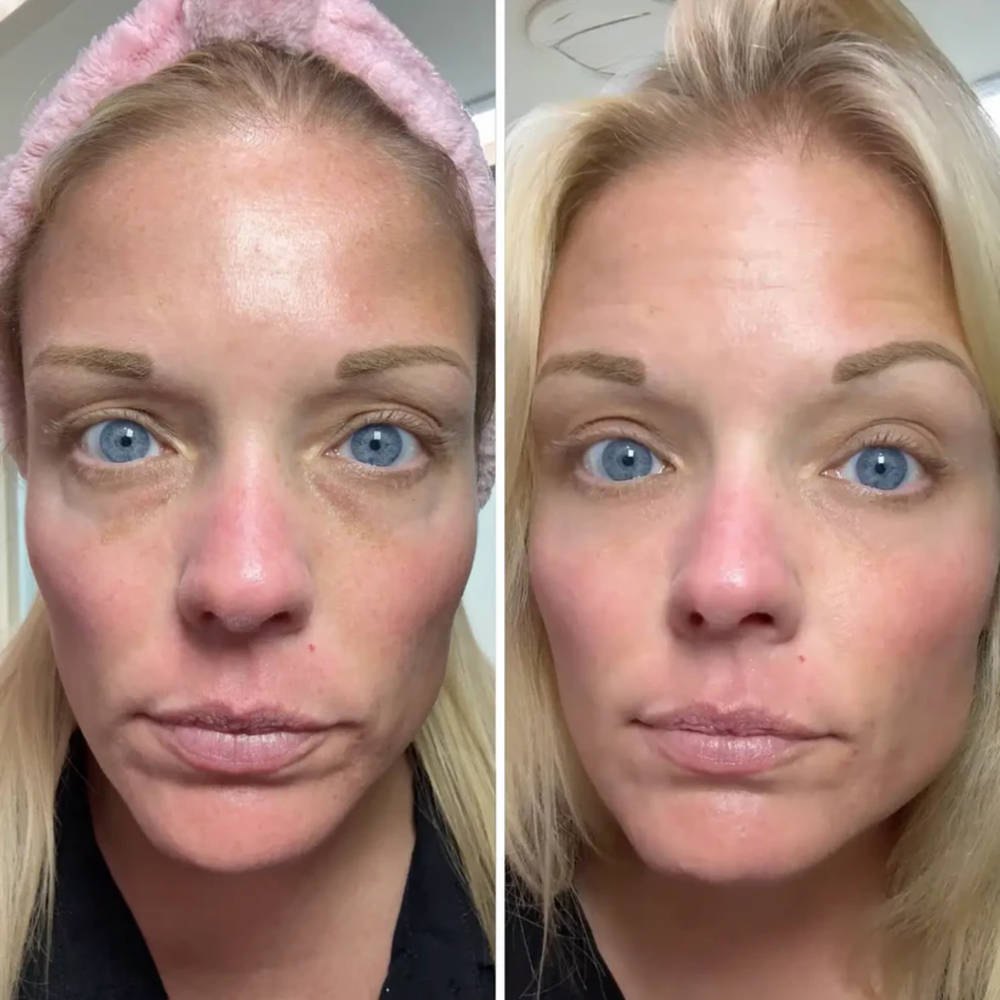 <h2>REAL RESULTS.</h2><h2>EXPERT APPROVED.</h2>