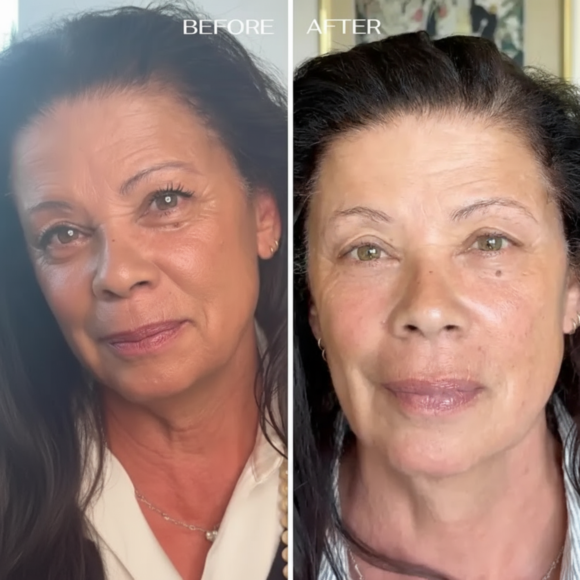 ALL-IN-ONE BALM FOR UNDER-EYE RENEWAL