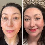 ALL-IN-ONE BALM FOR UNDER-EYE RENEWAL