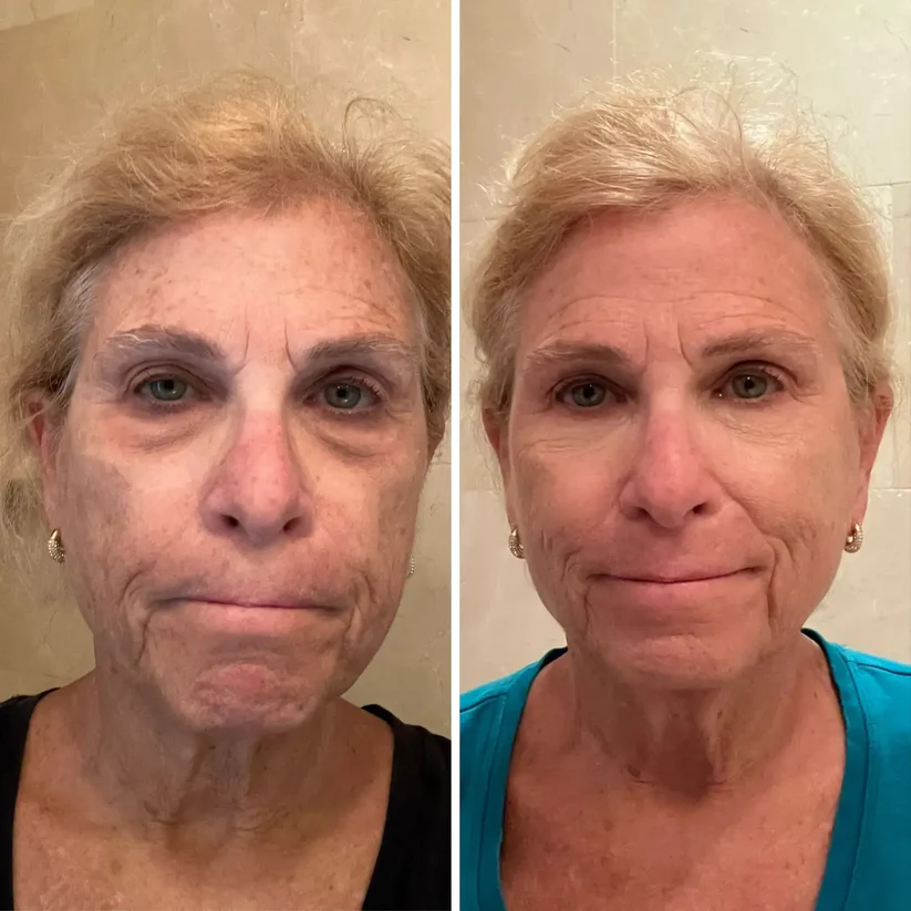 ALL-IN-ONE BALM FOR UNDER-EYE RENEWAL