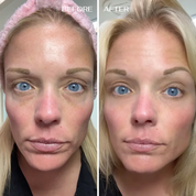 ALL-IN-ONE BALM FOR UNDER-EYE RENEWAL